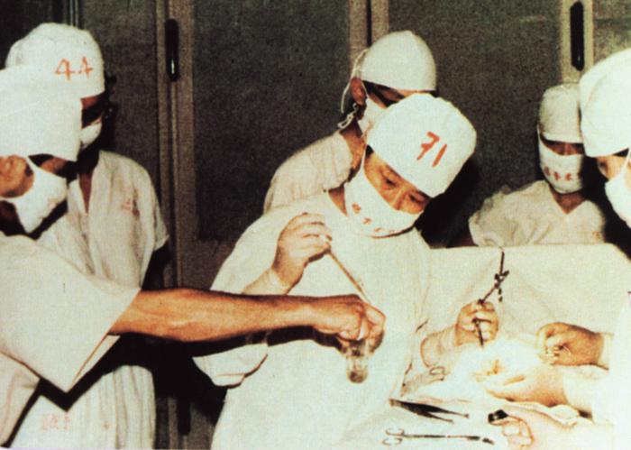 First case of experimental and clinical research study of islet cell transplantation in China in 1982